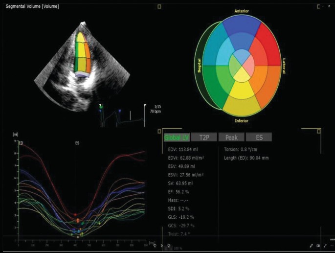 Artificial Intelligence in Echocardiography | Springer Nature Link ...