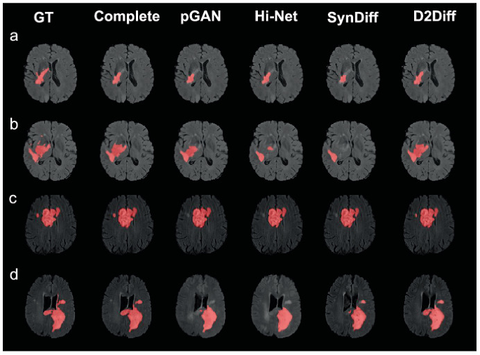 D2Diff: A Dual-Domain Diffusion Model for Accurate Multi-Contrast MRI ...