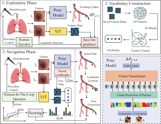 Bronchoscopy Visualization Navigational Bronchoscopy in Critical Care via End-to-End Pose ...