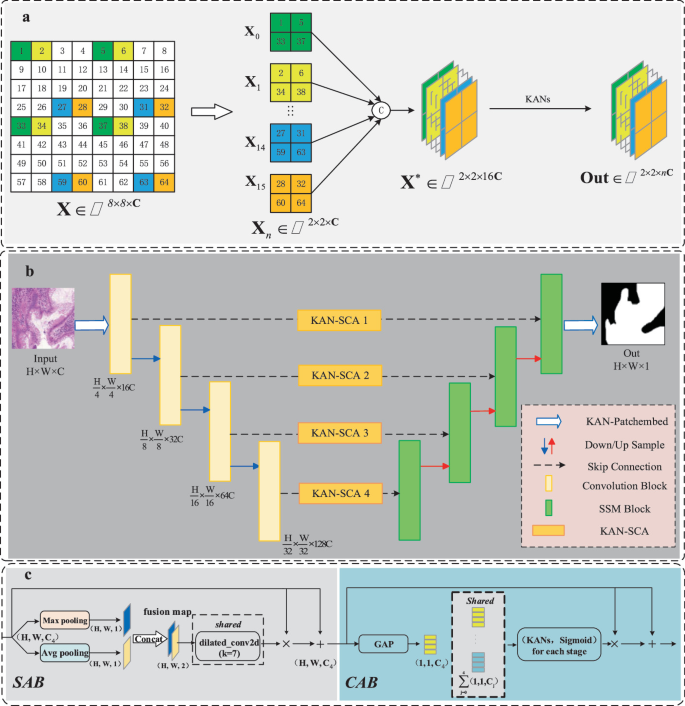 KMUNet: A Novel Medical Image Segmentation Model Based on KAN and Mamba ...