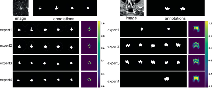 DiffOSeg: Omni Medical Image Segmentation via Multi-Expert ...