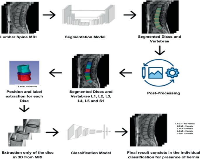 Deep Neural Networks to the Detection of Lumbar Hernias: Methodology ...