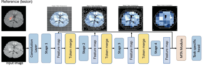 Toekn Visualization Lesion-Centered Vision Transformer for Stroke Outcome Prediction from ...