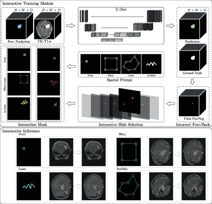 schematic diagram of interactive brain image... Domain-Specialized Interactive Segmentation Framework for Meningioma ...