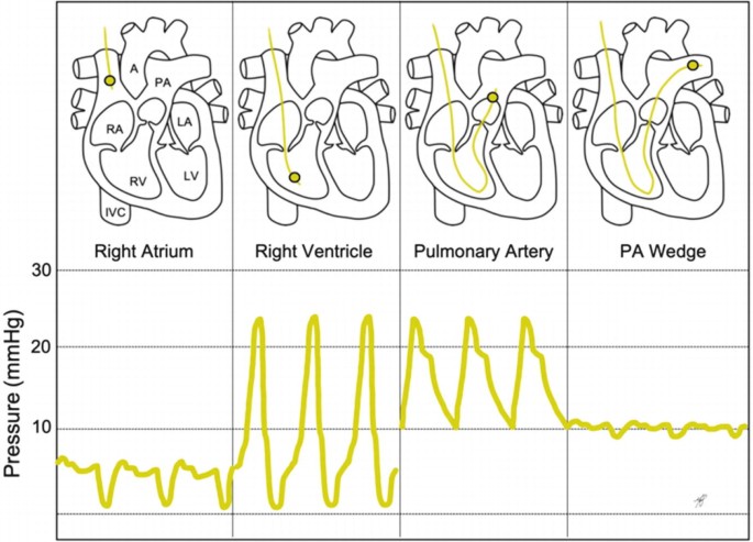 Central Lines | SpringerLink