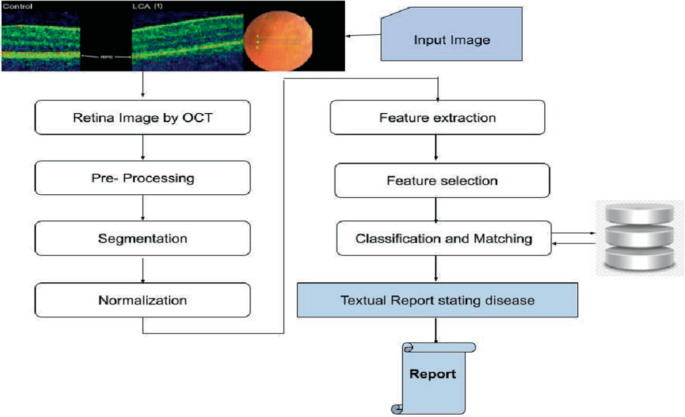 Retinal Optical Coherence Tomography Image Analysis for Text Report ...
