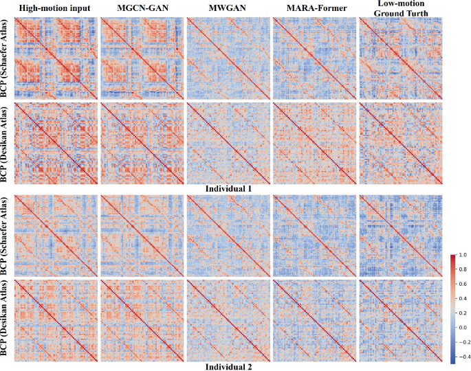 Joint Motion Correction of Multi-Atlas Functional Connectivity During ...