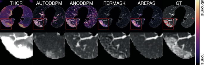 AREPAS: Anomaly Detection in Fine-Grained Anatomy with Reconstruction ...