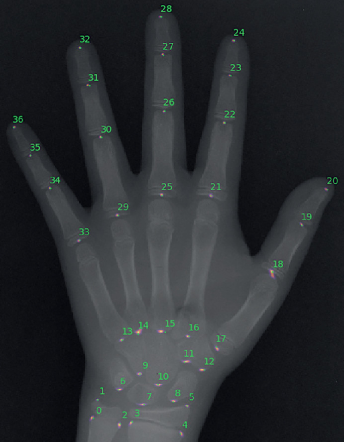 Hand Annotation X Ray A Handful of Data: Evaluating Few–Shot Incremental Landmark Detection ...