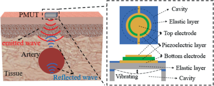 Piezoelectric Micromachined Ultrasonic Transducer for Carotid Arterial ...