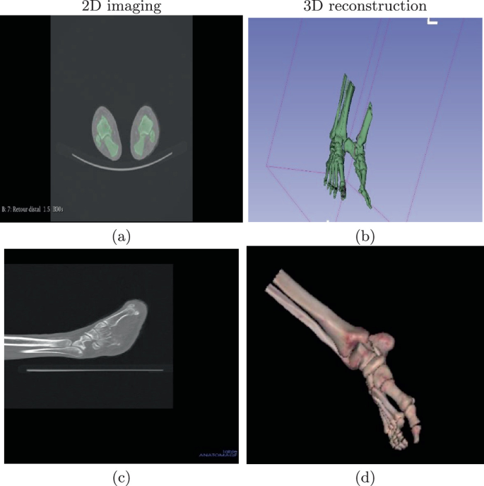 On the Use of 3D Modeling, Reconstruction and Printing Techniques for ...