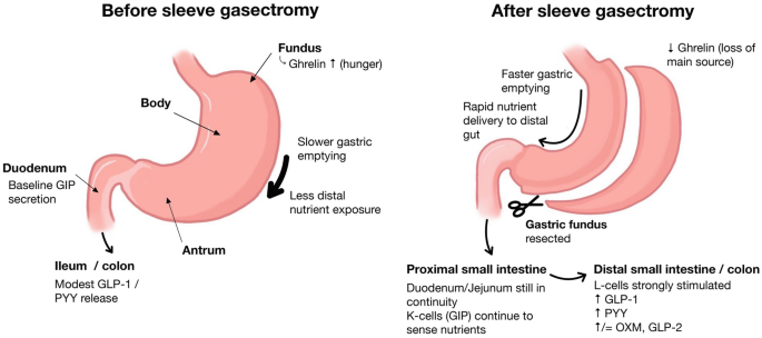 natural gip and glp-1 isn't a trend it's how your body works. Every time you eat, your gut releases GLP-1, a hormone designed to coordinate your metabolism, not override it. Here's what it does Hormonal and Biochemical Changes After