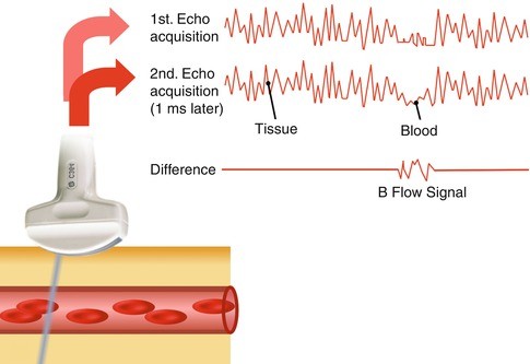 figure 38