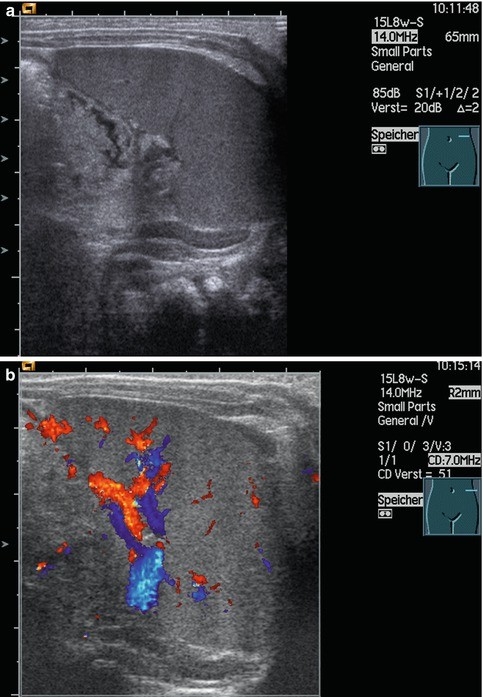 figure 29