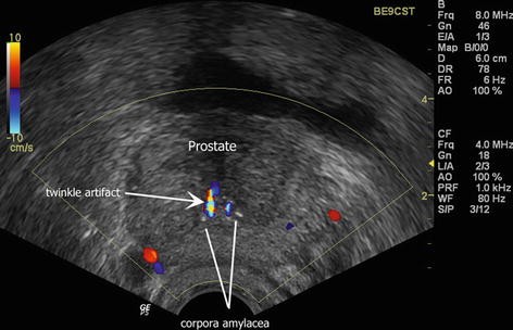 figure 29