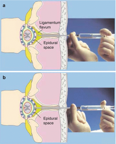 figure 28