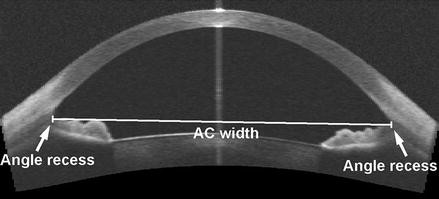 Anterior Eye Imaging with Optical Coherence Tomography | SpringerLink