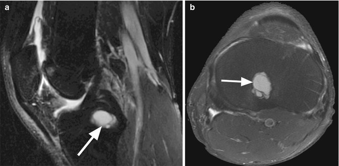 figure 37