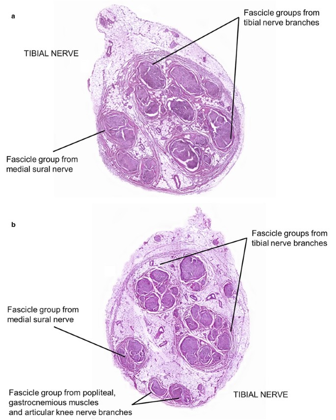 peripheral nerve histology cross section