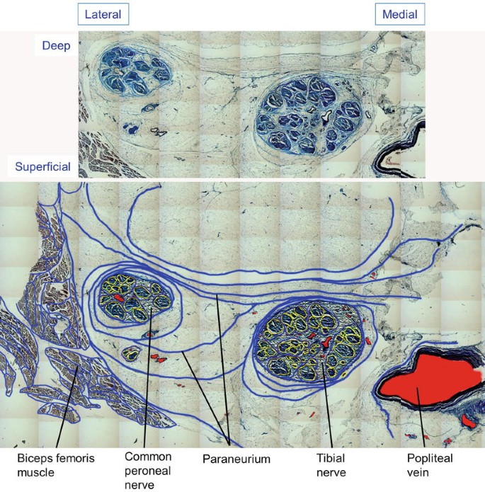 figure 21