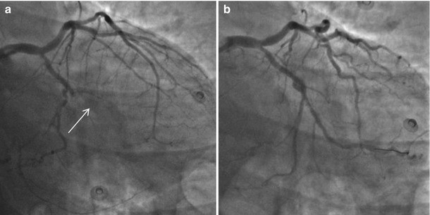 figure 17