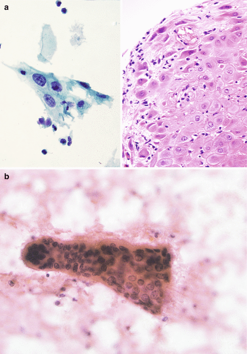 figure 29