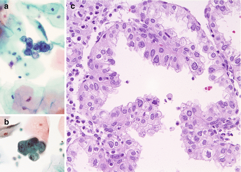 figure 30