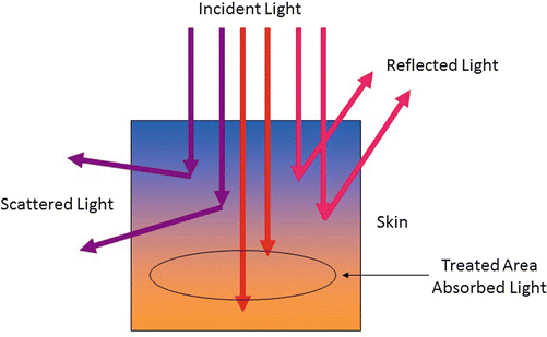 figure 28