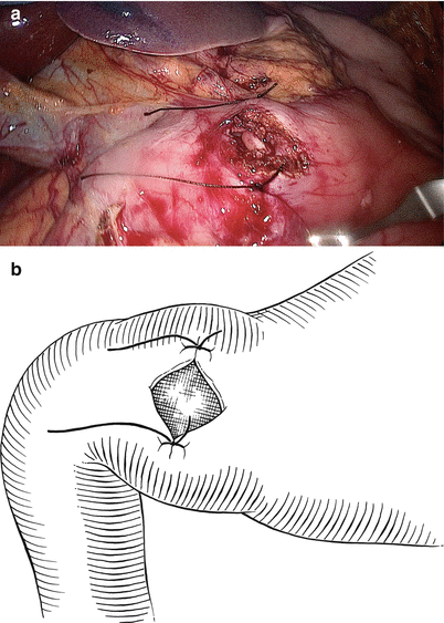 figure 30