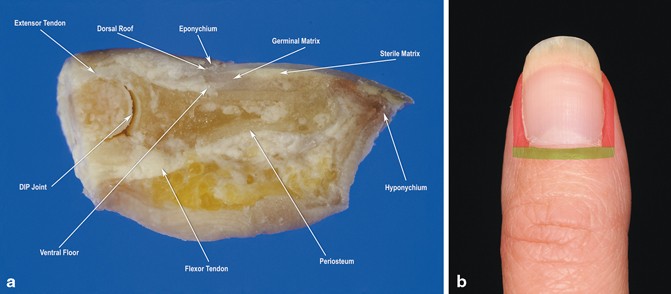 Tumors of the Nail Apparatus and Adjacent Tissues