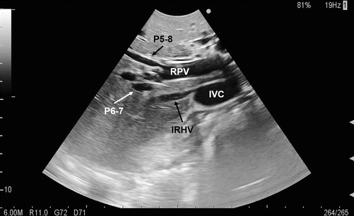 figure 22