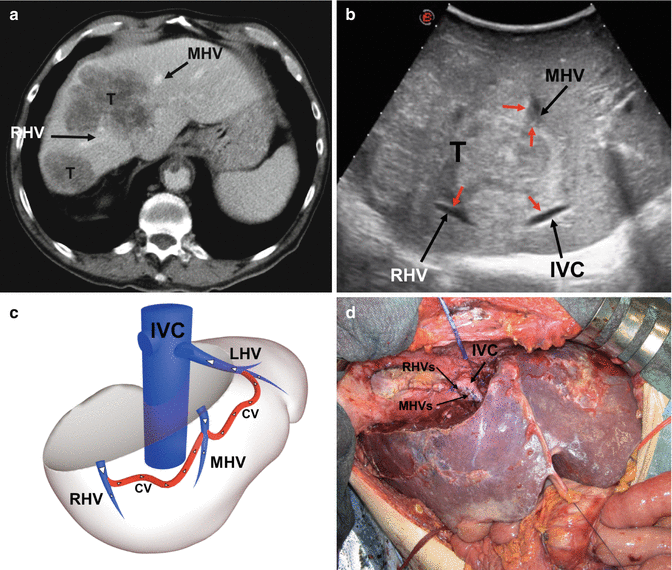 figure 27