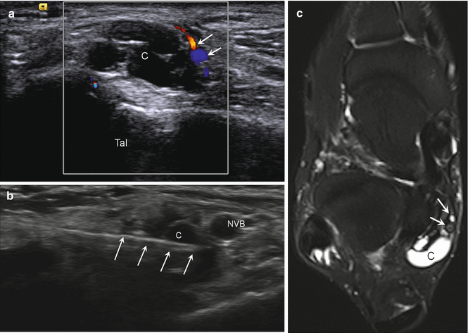 figure 116