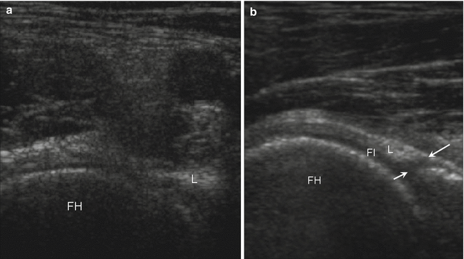 figure 119