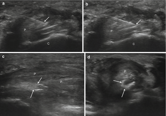 figure 123