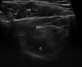 figure 36