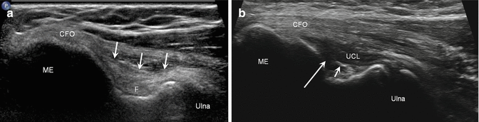 figure 49