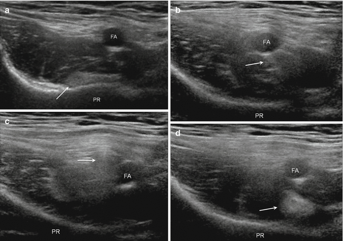 figure 70