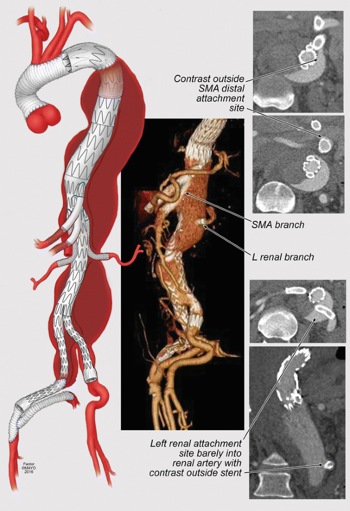 figure 23