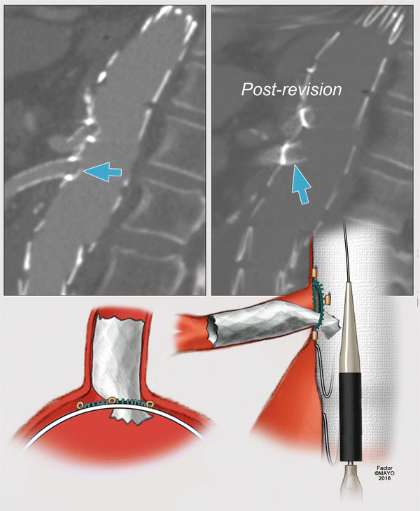 figure 32