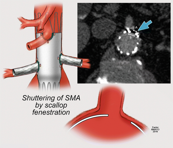 figure 34