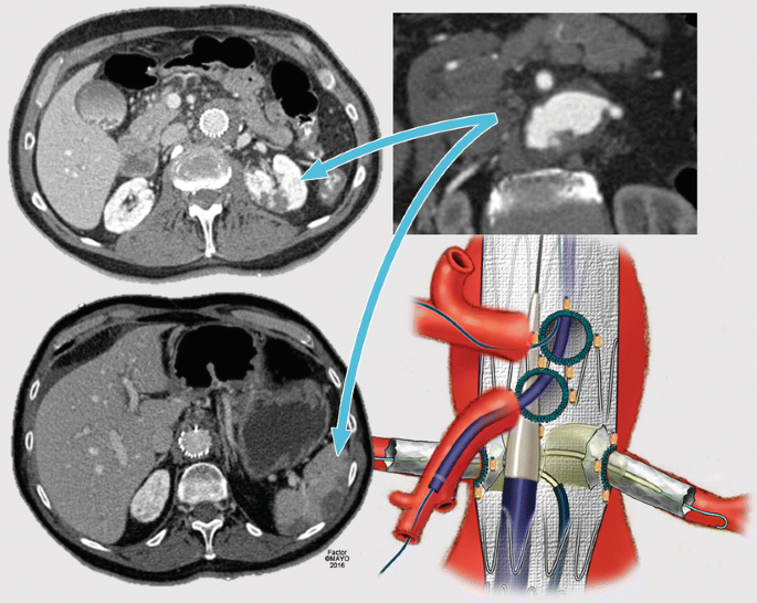 figure 37