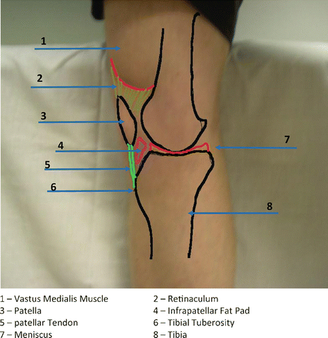 tibial tubercle palpation