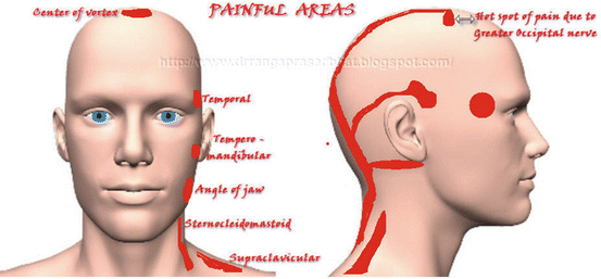 Trigger Point Therapy - PremierMED