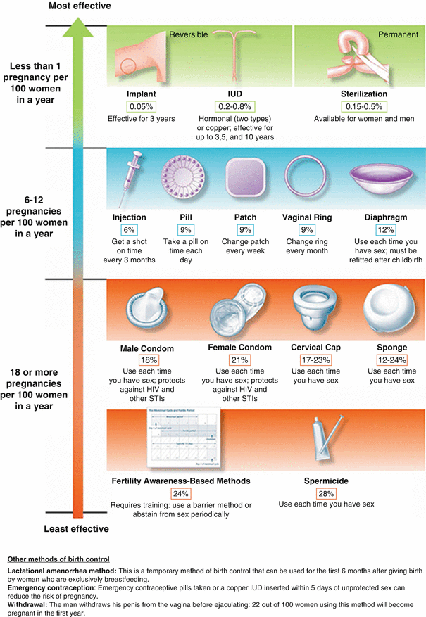 PDF) Female sterilisations with Filshie clips: What is the risk failure? A  retrospective survey of 30 000 applications