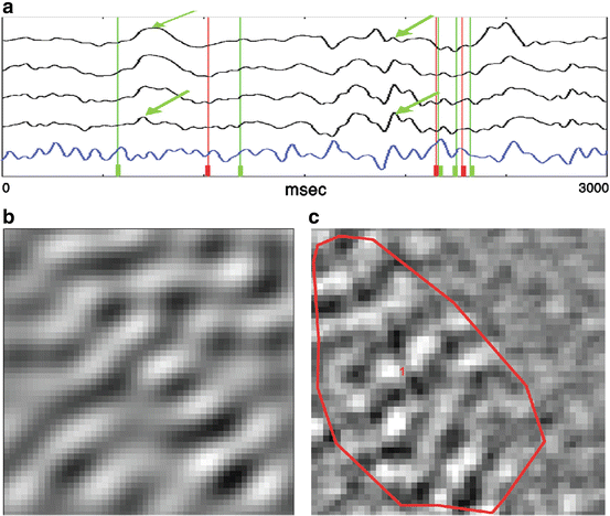 figure 15