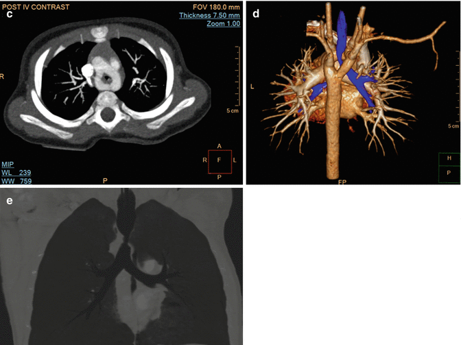 figure 33