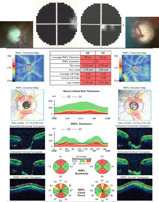 figure 24