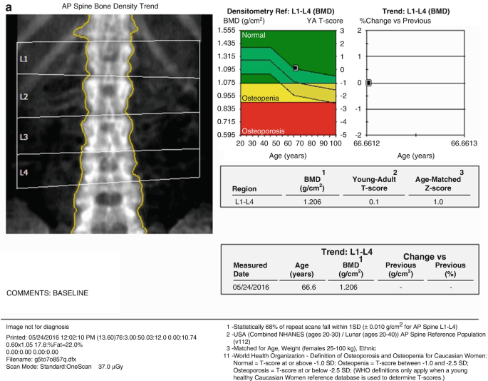 figure 18