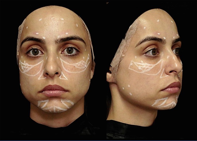 Three-Dimensional Approach of Cosmetic Patient: Aging Gracefully